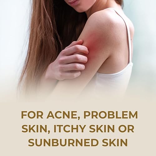 Miniatura 5 de Barra de jabón de leche de cabra con miel de avena 4 onzas jabón de barra natural para mujeres hombres niños picazón en la piel eccema psoriasis