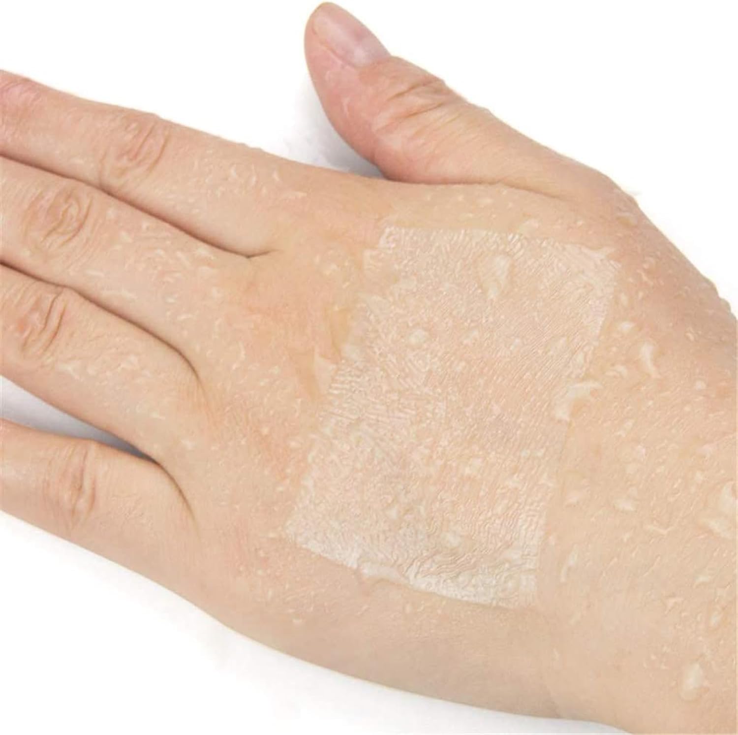 Barriera Impermeabile per catetere peritoneale, Prodotti monouso per la Cura Speciale per pazienti in dialisi peritoneale, 100 Pezzi