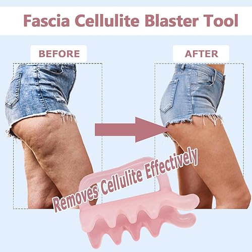 Miniatura 4 de Herramienta de masaje para la celulitis, puntos de activación, herramienta de liberación miofascial para cuello, hombro, espalda, masajeador