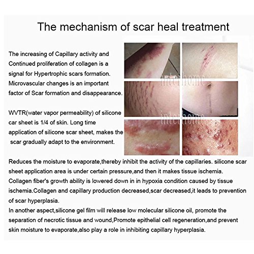 Medical Scar Away Patch Silicone Gel Sheet Wound Marks Removal Cesarean