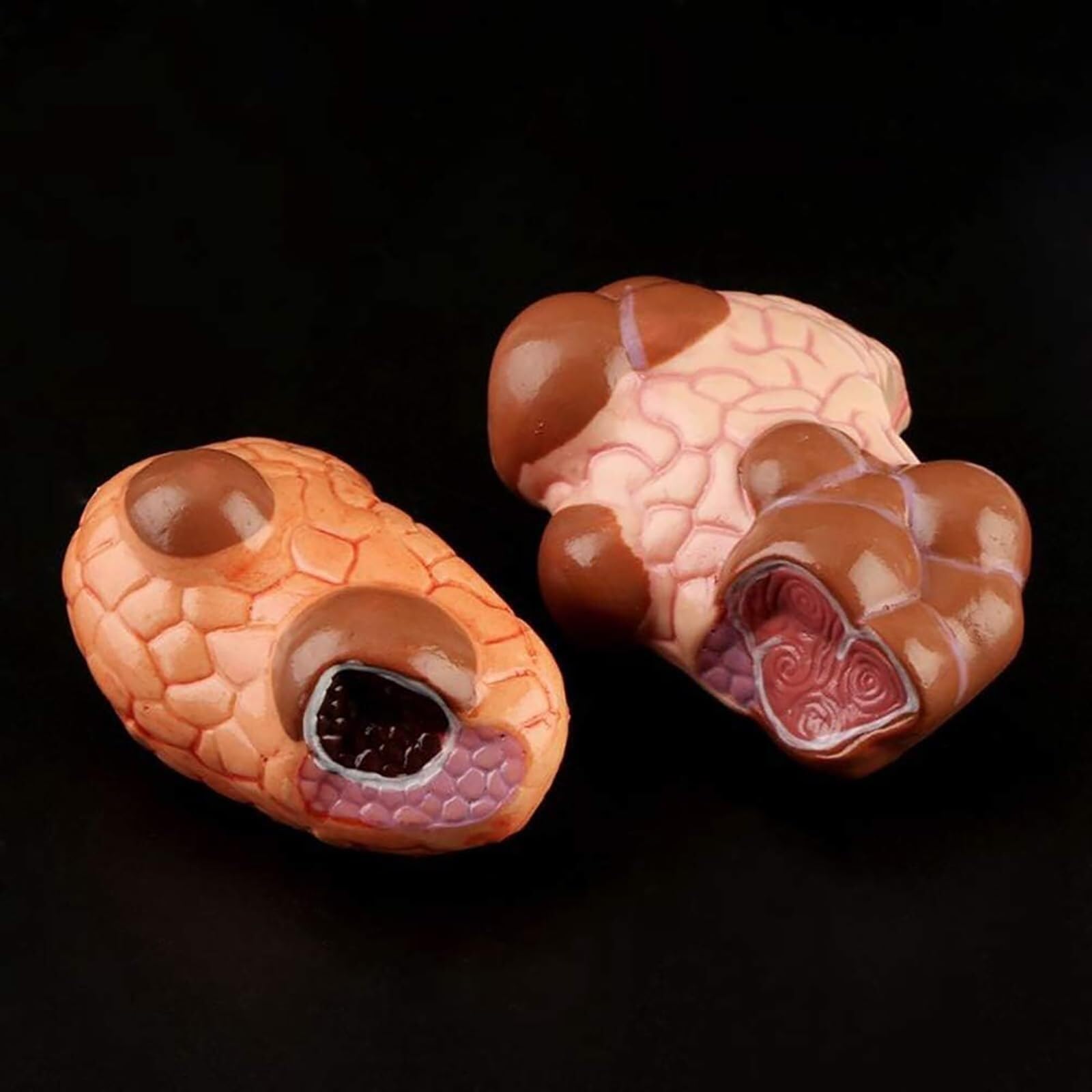 model anatomiczny, Model torbieli guza gardła tarczycy