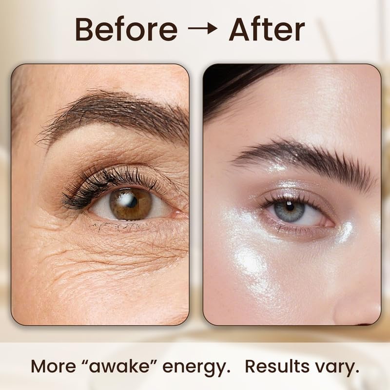 Retinol Eye Balm for Under Eye Care, Repair Dark Circles, Eye bags, Fine Lines & Dryness, Hydrating & Smoothing Eye Cream, 14.50 ml