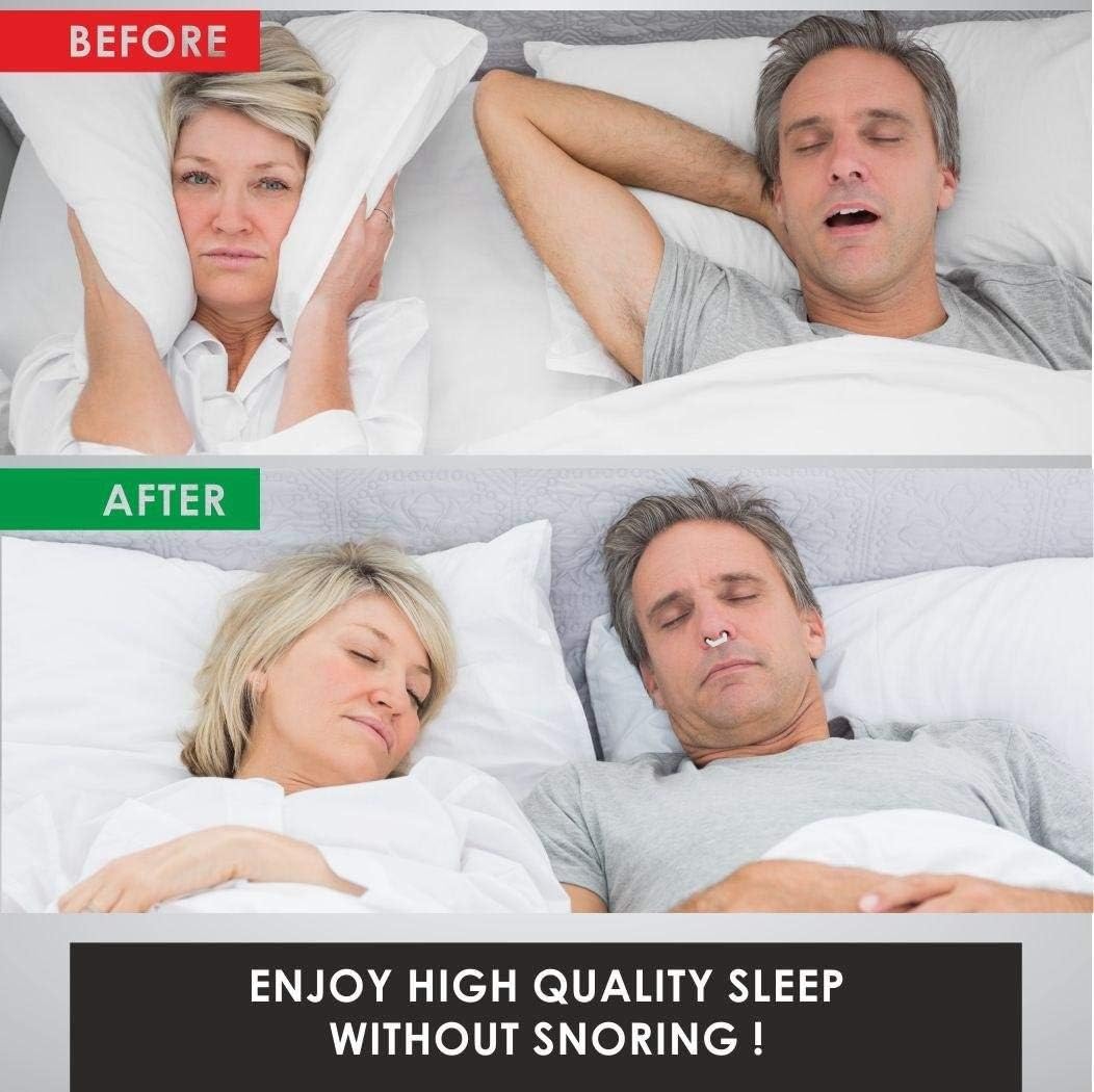 4X Anti Snoring Solution, Professional Anti Snoring Devices, Silent Snore Reducing Aid for Men and Girl, Snore Away Nose Vents, Snore Stopper Nose Clip : Health & Household