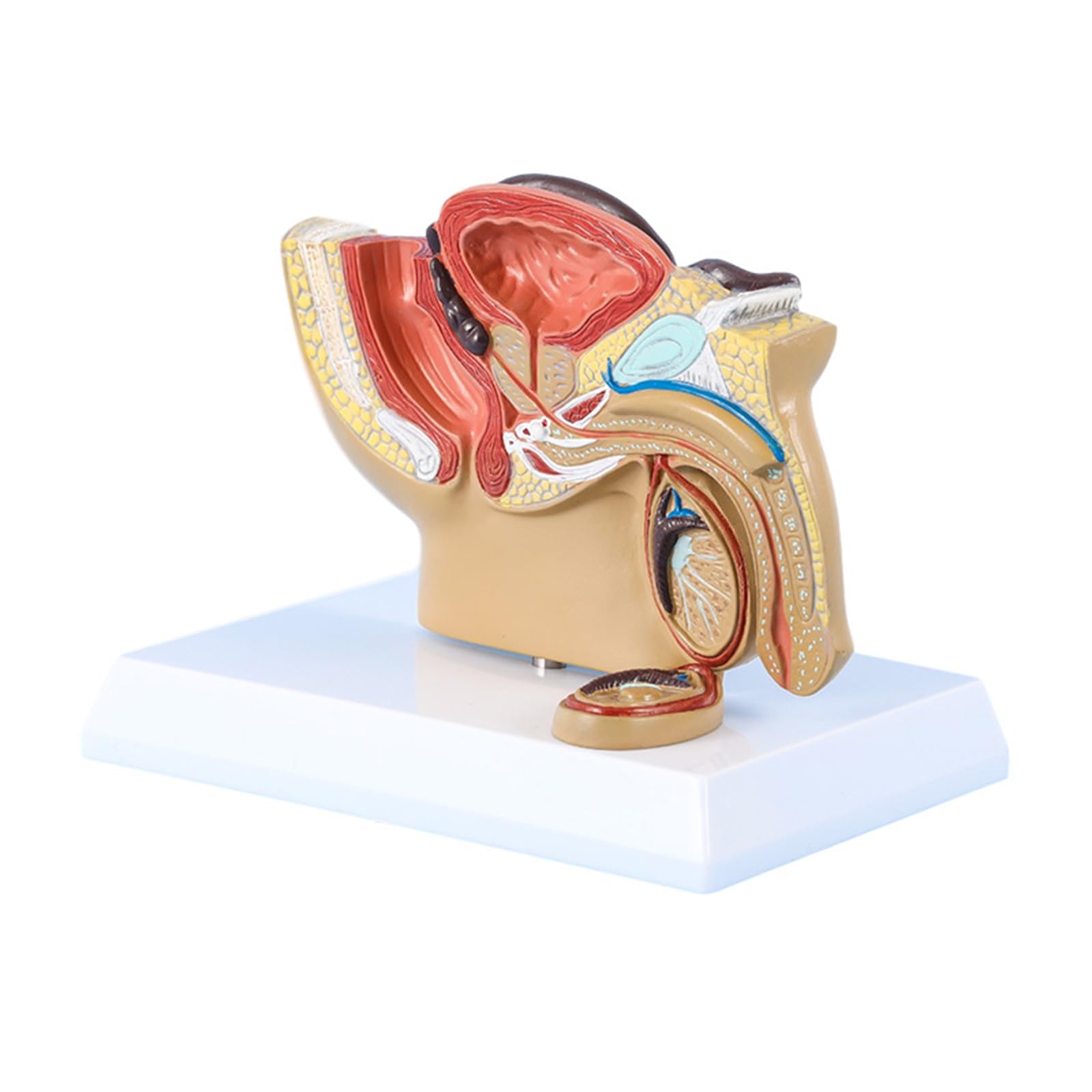 CcacHe Modelo de anatomía pélvica Masculina, Modelo anatómico patológico, Modelo de órgano médico para Estudio de investigación de Estudiantes de Medicina