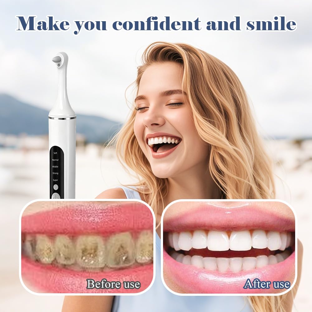 Limpiador de sarro con 5 cabezales, pulidor de dientes, juego profesional de limpieza dental con 5 modos para limpieza dental y blanqueamiento de dientes, para pulir después de la limpieza dental