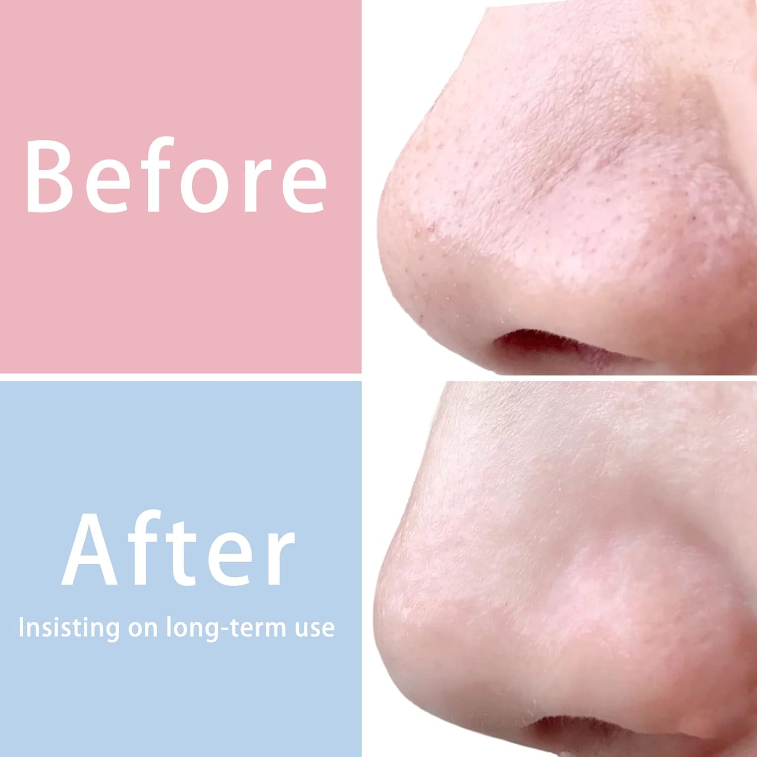 MIG4U 3 PCS Exfoliating Facial Scrubber Mitt, Face Cleanser Wash Mittens Exfoliator for Men & Women Dead Skin Cleaning Gloves - Image 4