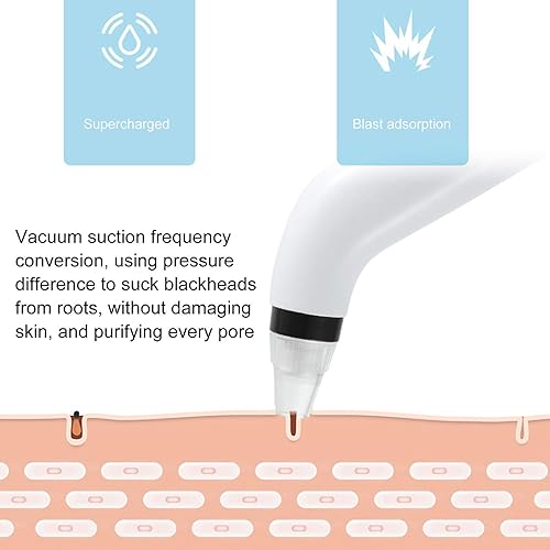 Miniatura 6 de Aspiradora removedor de puntos negros, aspiradora removedor de puntos negros, dispositivo de eliminación de puntos negros recargable por USB con
