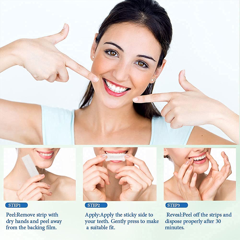 56 PCS Strisce Sbiancanti Denti 5D Schloss, Teeth Whitening Strips con Adesione unica, Dental Whitestrips Ricche di Fattore Sbiancante e Fattore Antiallergico, Comode e Prive di Acido Dentale