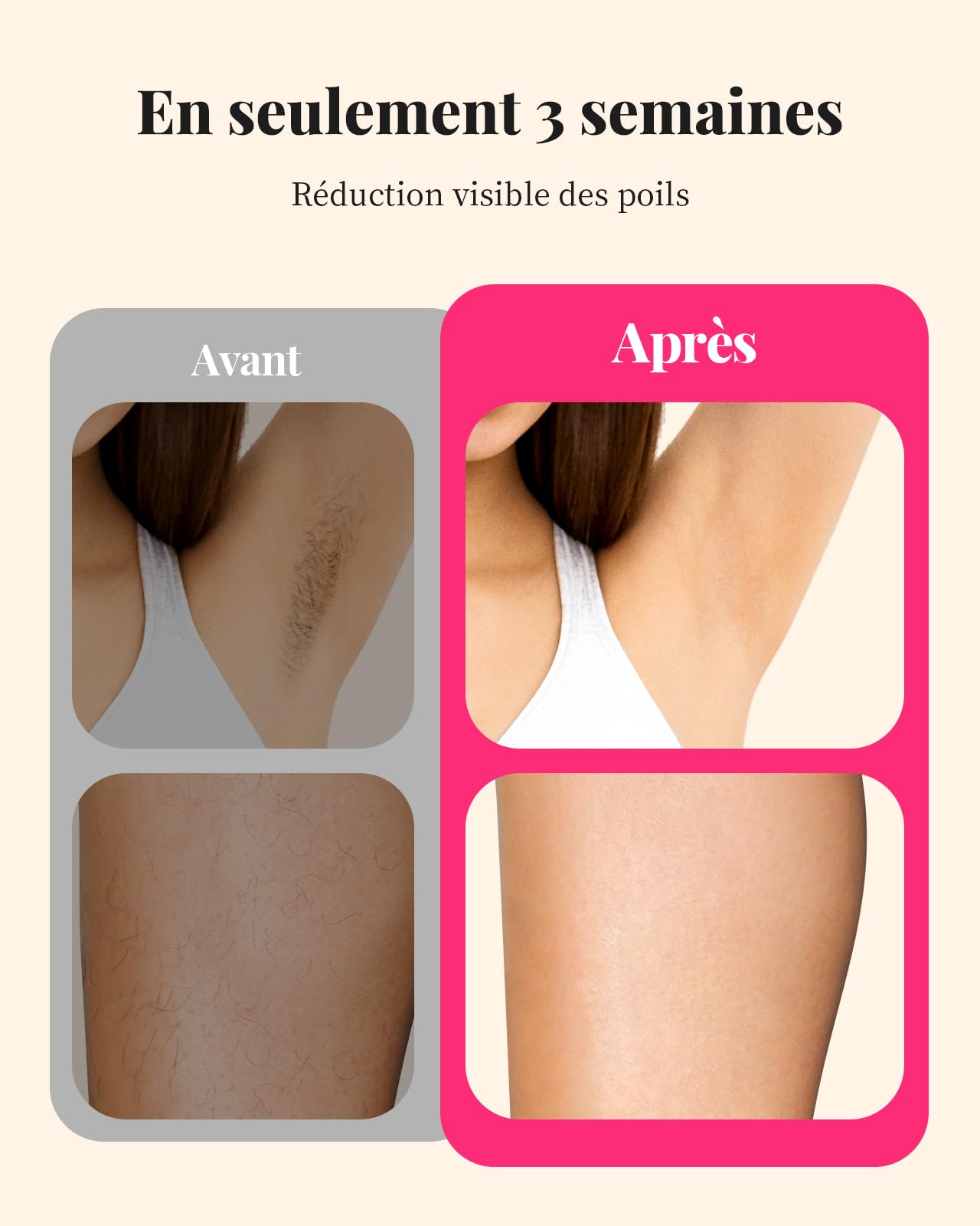 Haarlosy Épilateur Lumière Pulsée, 22J Épilateur Laser avec Grand Écran LCD, 3 Fonctions[HR/SR/HR+], 9 Niveaux D'énergie, IPL Épilation Laser Hair Removal pour Aisselles/Maillot/Crops - Blanc