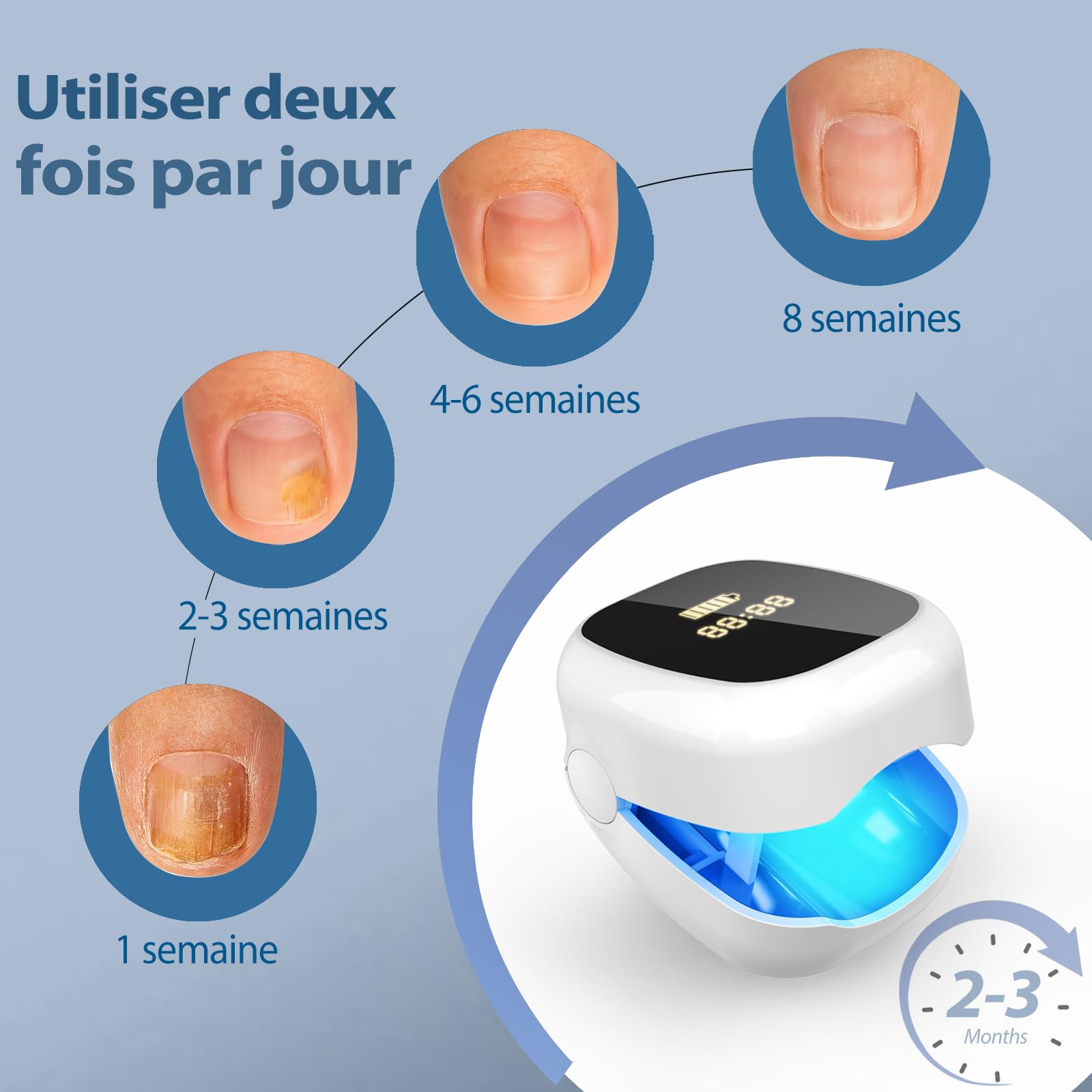 Laser Mycose Ongle Pied - Appareil Mycose Ongle Pied avec Laser Ongle à Doubles Longueurs d’Onde et Affichage de l’Heure pour le Traitement d’Appoint de la Mycose Ongles des Pieds, Blanc