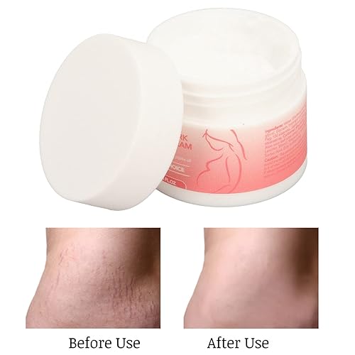 Miniatura 5 de Stretch Mark Removal Cream Stretch Mark Lightening Cream Firming Skin Promotes Healing and Reduces Scars to Improve Skin Elasticity