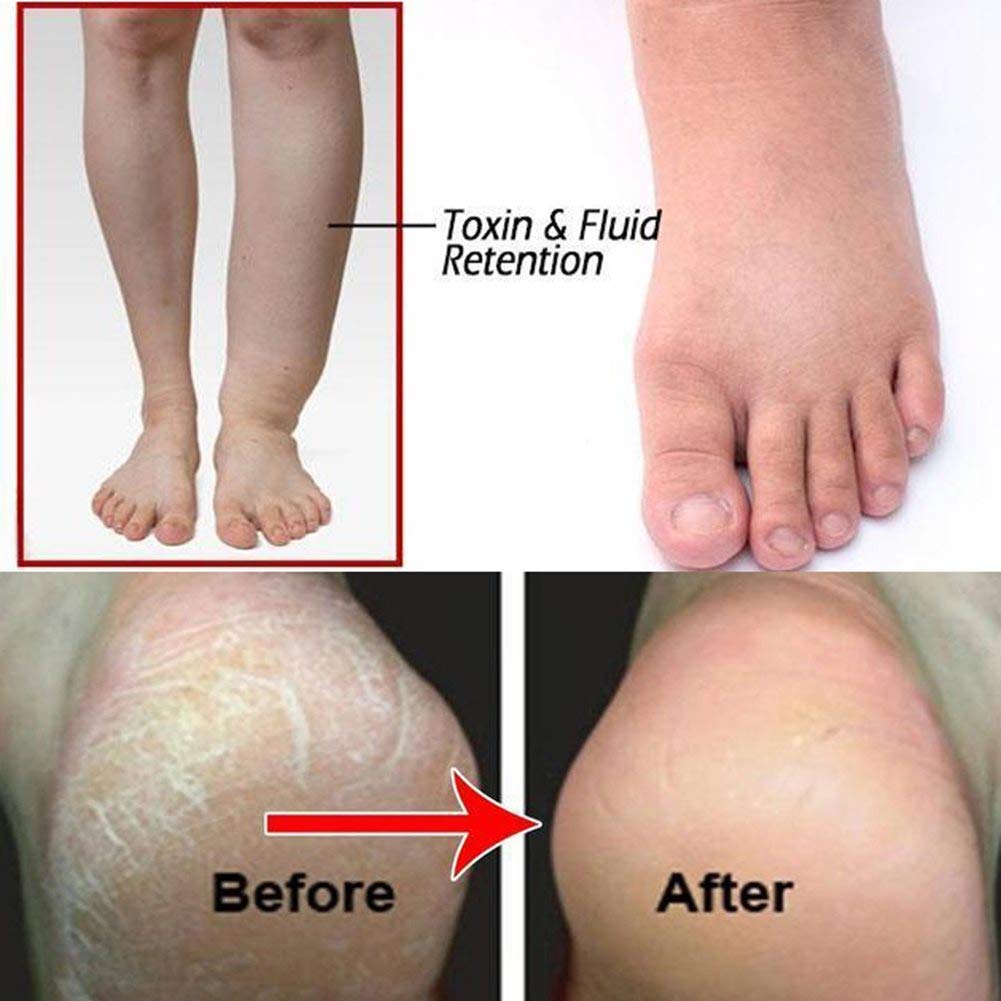 10Pcs Ginger Foot & Hand Salts & Soaks Foot Care,Eliminate Fatigue Improve Sleeping Foot Pain Foot Care Treatment : Beauty & Personal Care