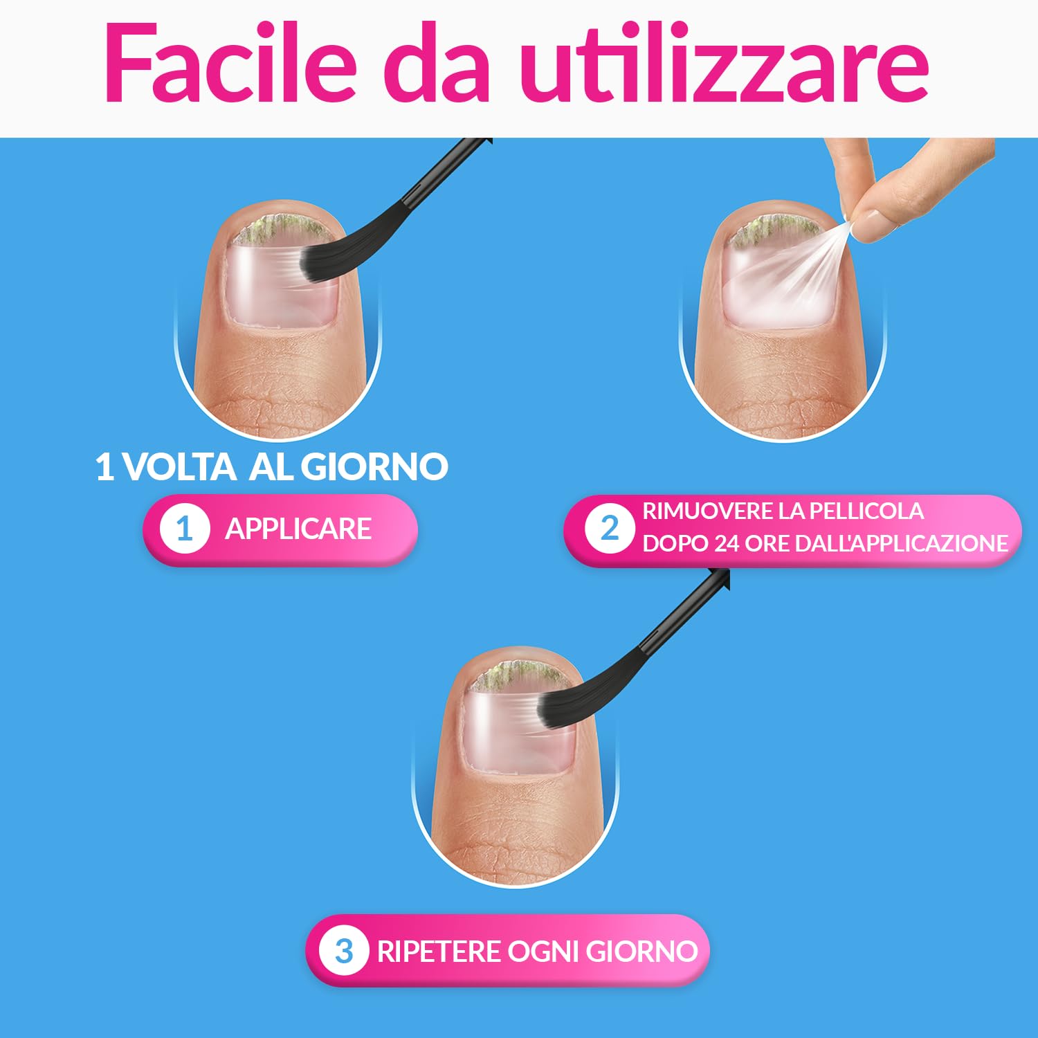 Excilor Micosi dell’unghia Forte, Trattamento della Micosi dell'Unghia Attivo Contro le micosi Persistenti, Confezione da 30 ml
