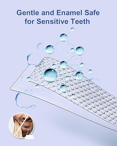 MySmile Teeth Whitening Strips Kit 14 Treatments with — packaging and what arrives in the box