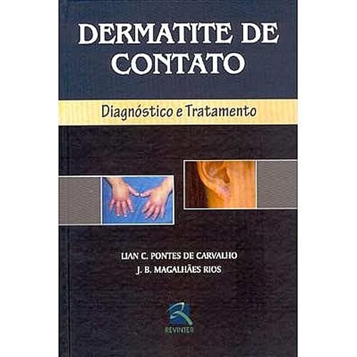 Dermatite de Contato: Diagnóstico e Tratamento