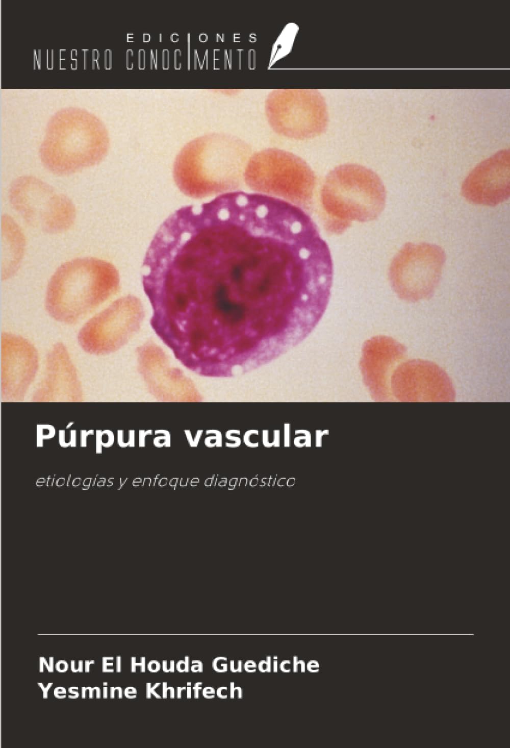 Púrpura vascular: etiologías y enfoque diagnóstico