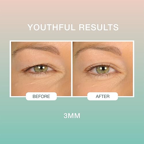 Miniatura 2 de Contours Rx Tapas por diseño - Tiras de elevación de párpados no quirúrgicas e invisibles - para una apariencia más juvenil, remodelar y definir con