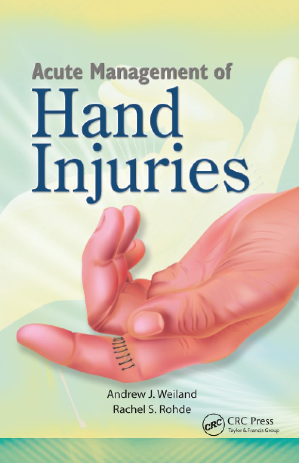 Buy Acute Management of Hand Injuries — BookShops.in