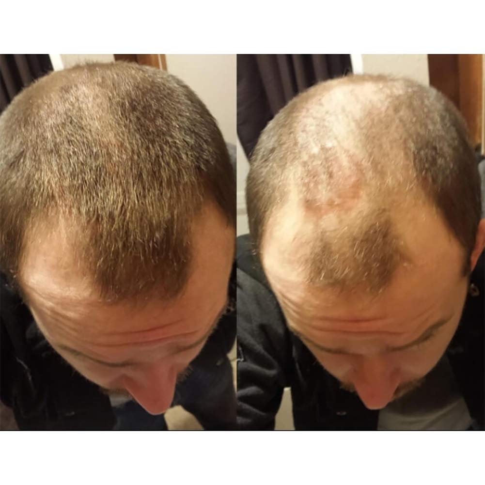 Fibras de Cabello Naturales para Cabello Fino y Escaso, Efecto Inmediato (Marron oscuro)