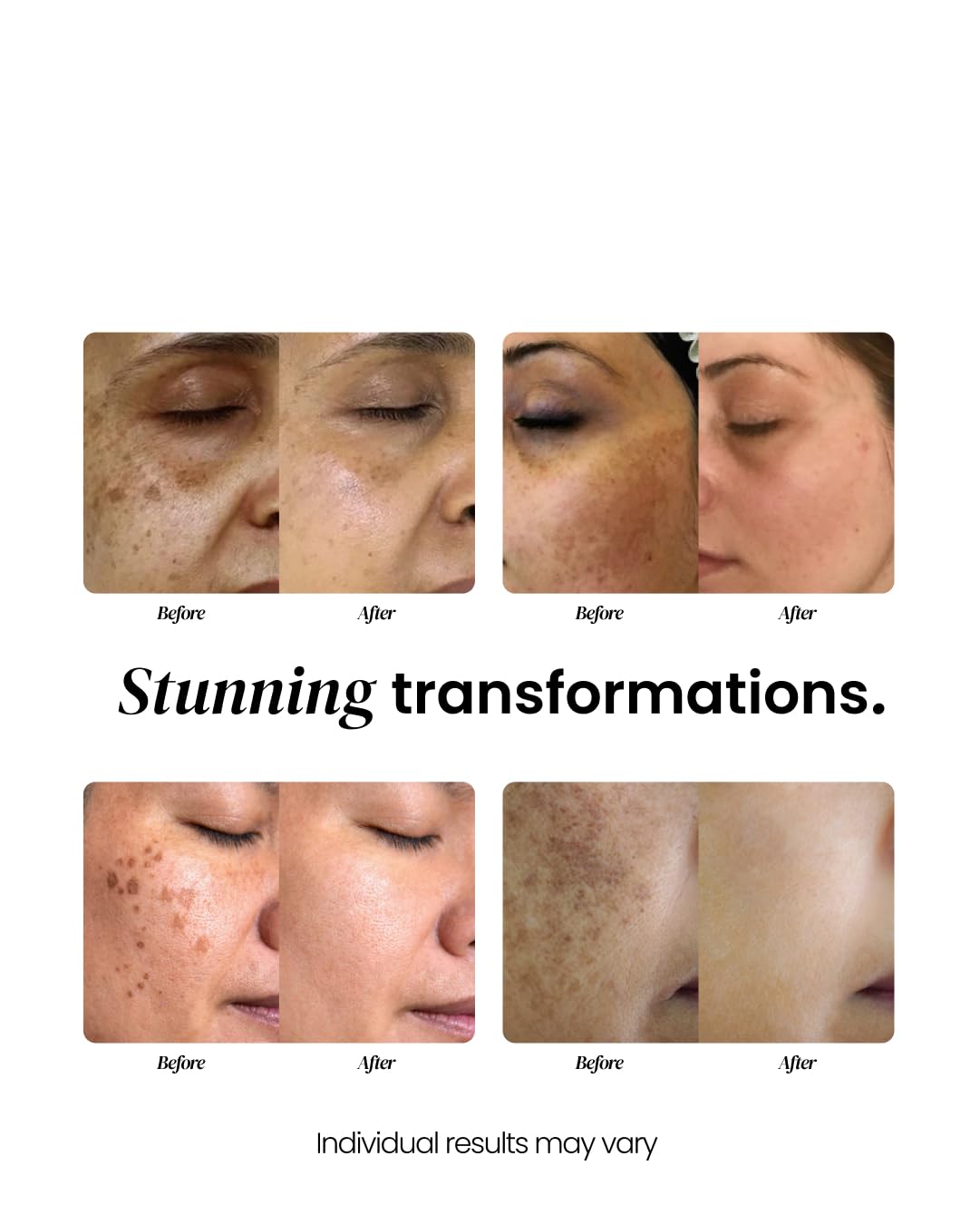 Radiance & Renewal Serum with Hyaluronic Acid, Vitamin C & Kojic Acid – Hydrating Anti-Aging Formula for Smooth, Even-Looking Skin Tone & Texture – 30ml - Image 8