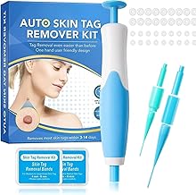 EASEPRES Upgraded 2-in-1 Skin Tag Removal Kit – Auto Skin Tag Remover for Micro to Large Tags (2mm–8mm) – Includes Micro & Regular Removal Bands – Safe & Effective Skin Tag Remover Tool