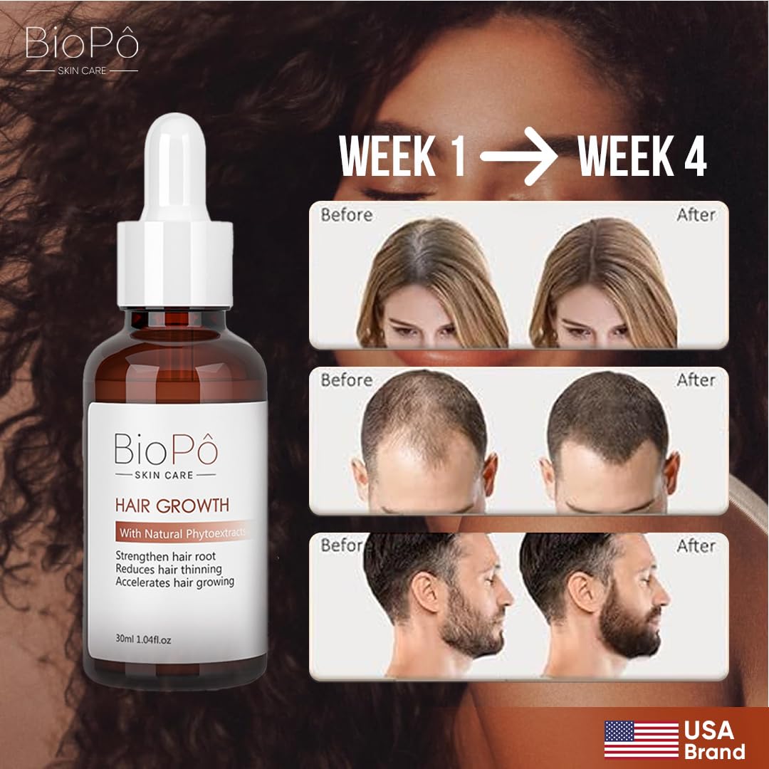Hair Growth Serum, Strengthen Hair Root, Reduces Thinning, Accelerates Growth, Hair Loss Treatment Strengthens Roots, Nourishes Scalp, Fast-Absorbing, Protects from Damage, 30ml