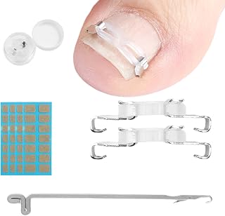 JIUDOUCUOIngrown Toenail correction Kit, Professional Nail Care Tools with Correction Clips and Adhesive Pads，Four correction clips can correct two toenails simultaneously