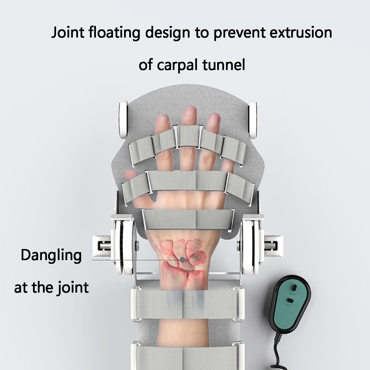 Dispositivo eléctrico de rehabilitación de articulaciones de muñeca, Ejercitador de articulaciones de hemiplejia por accidente cerebrovascular con control remoto, Férulas de mano fijas en reposo para