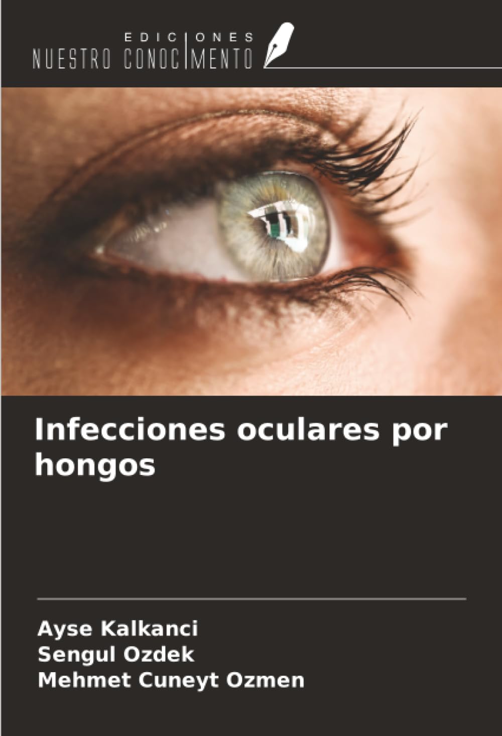 Ediciones Nuestro Conocimiento Infecciones Oculares Por Hongos