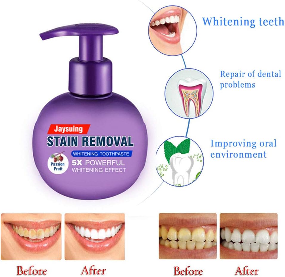 Baking Soda Whitening Toothpaste, SuperThinker Stain Removal Whitener Teeth Fight Bleeding Gums Fresh Breath Toothpaste for Sensitive Teeth, Refreshing Bright Tooth