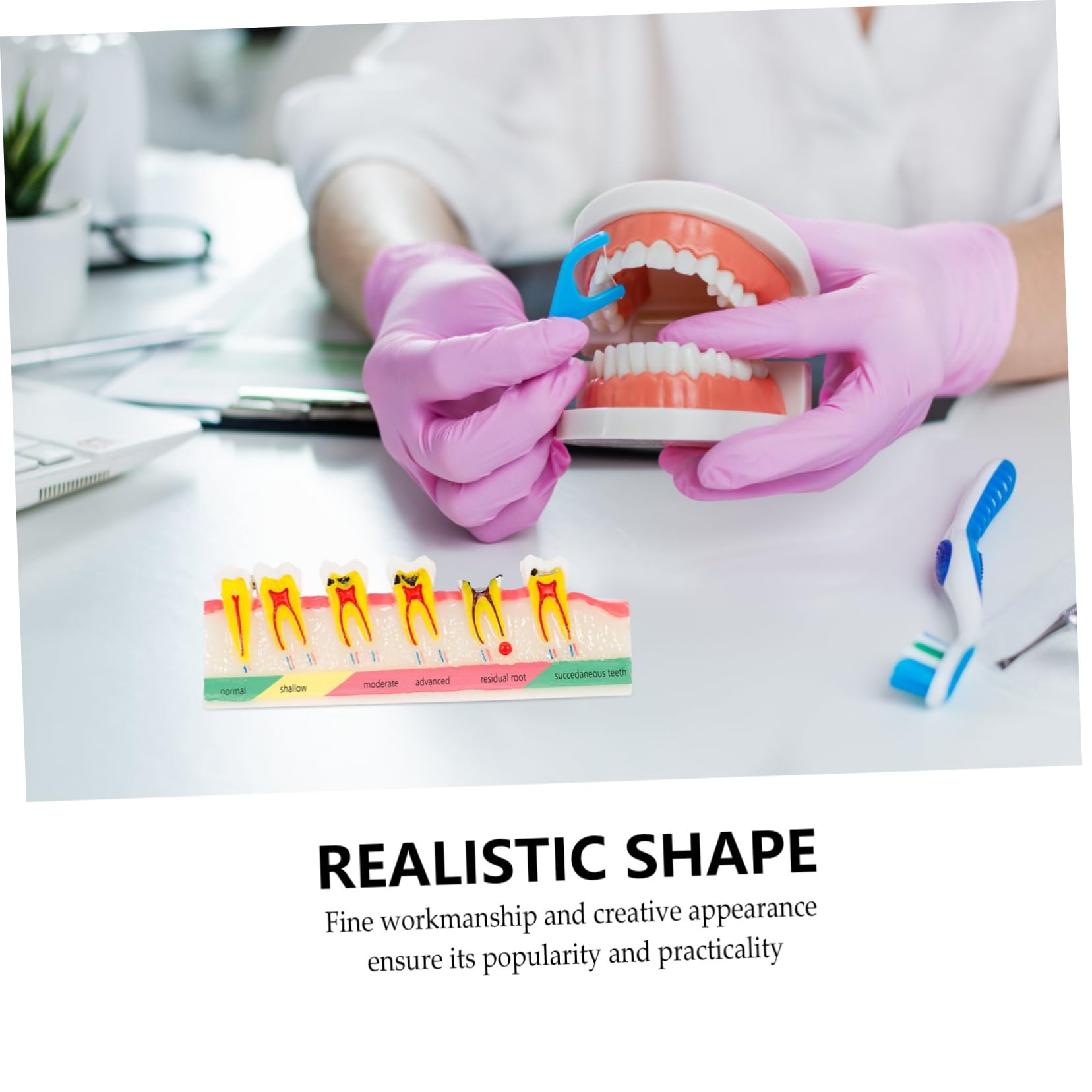 ULTECHNOVO 2pezzi Didattico Di Dente Per Carie e Decadenza Strumento Formativo Per Educazione Medica e Studio Odontoiatrico Patologico Per Presentazioni e Dimostrazioni Cliniche