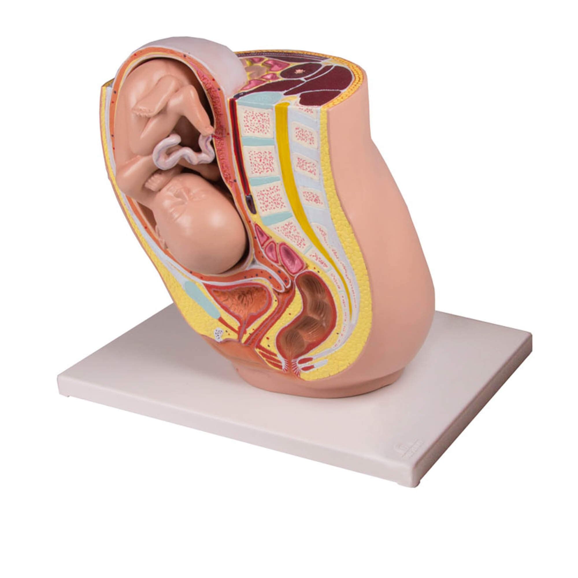 Schwangerschaftsbecken mit Fetus 32. Schwangerschaftswoche