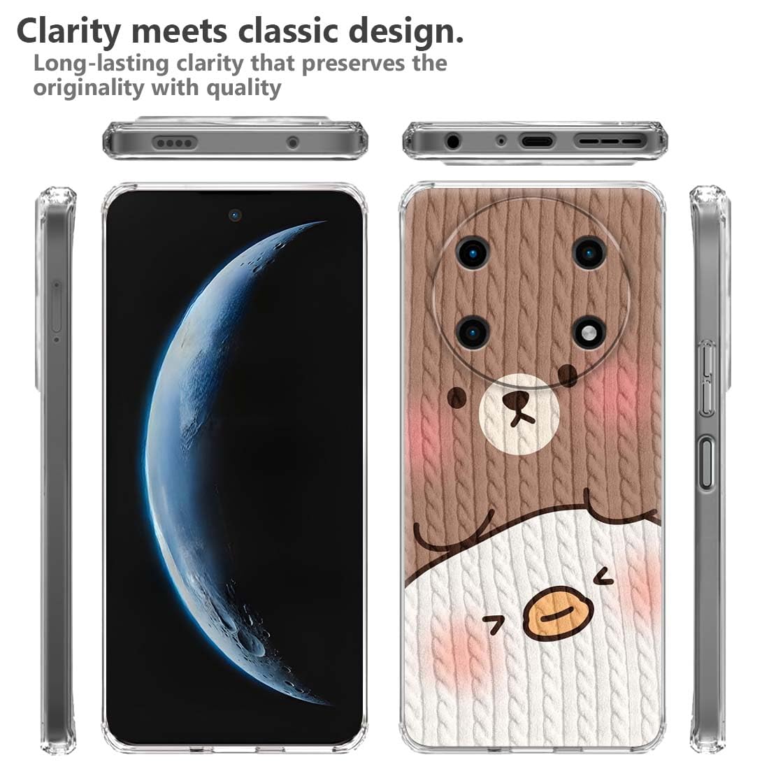 Fashionury Designer Soft Back Cover Case Compatible for Acer Super