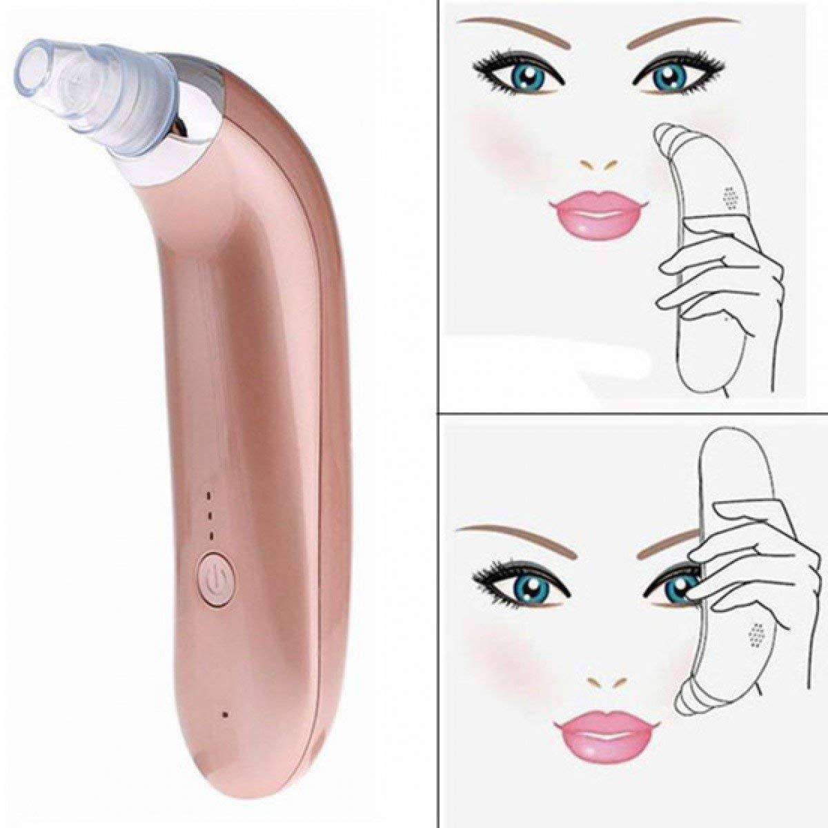 AR Mall Electronic facial blackhead spot vacuum remover machine 1 psc AR Mall Electronic facial blackhead spot vacuum remover machine 1 psc