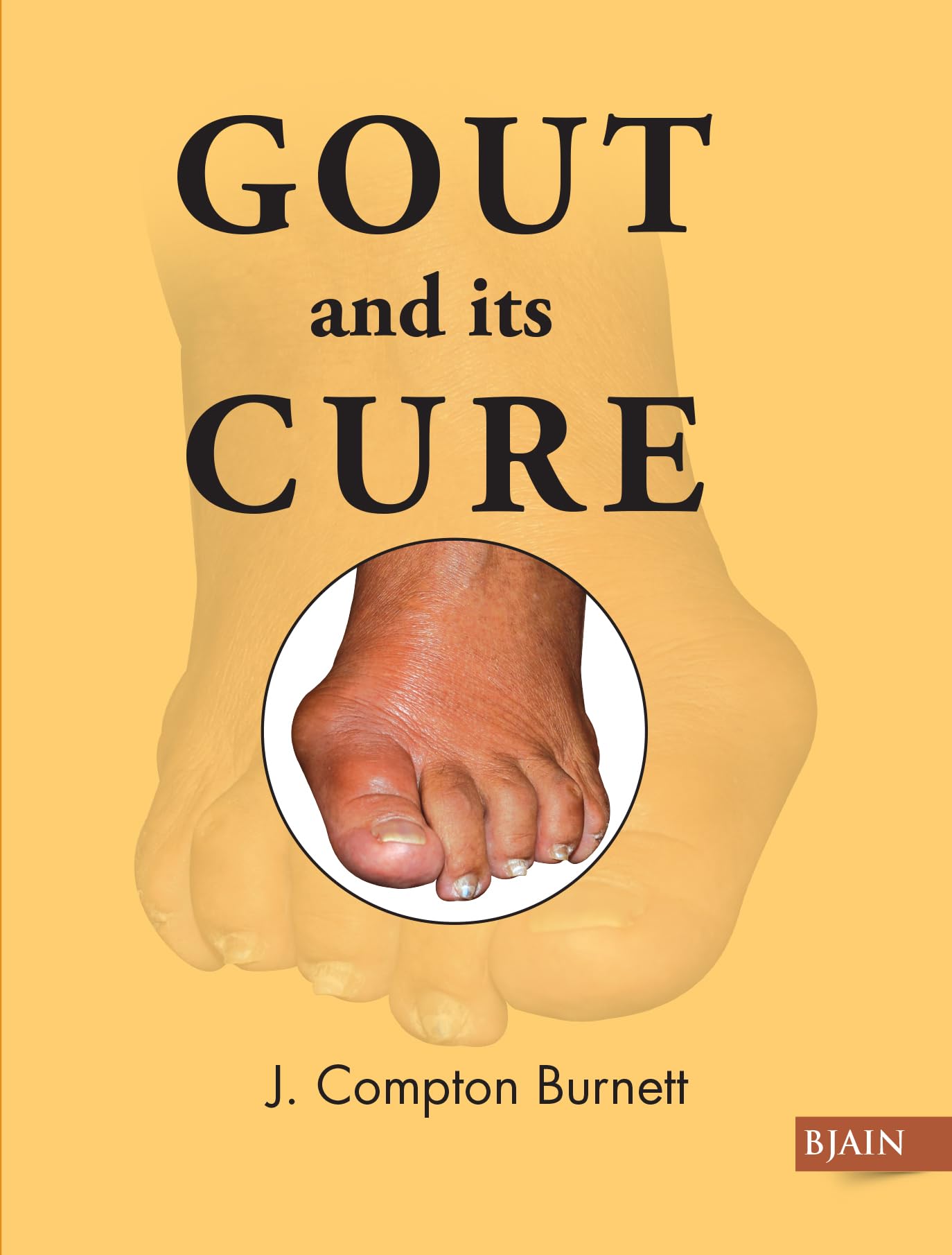 Gout & Its Cure Paperback – August 1, 2012