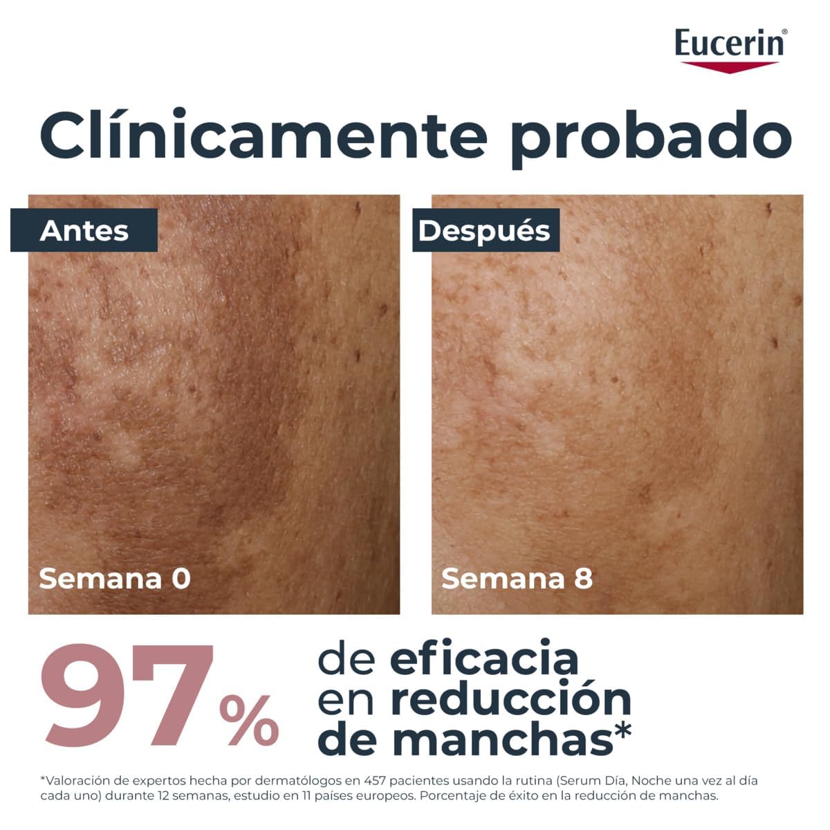 Eucerin Anti-Pigment Dual Serum (30 ml), sérum facial concentrado antimanchas para una piel uniforme y suave, tratamiento con Ácido Hialurónico y Thiamidol, para todo tipo de pieles