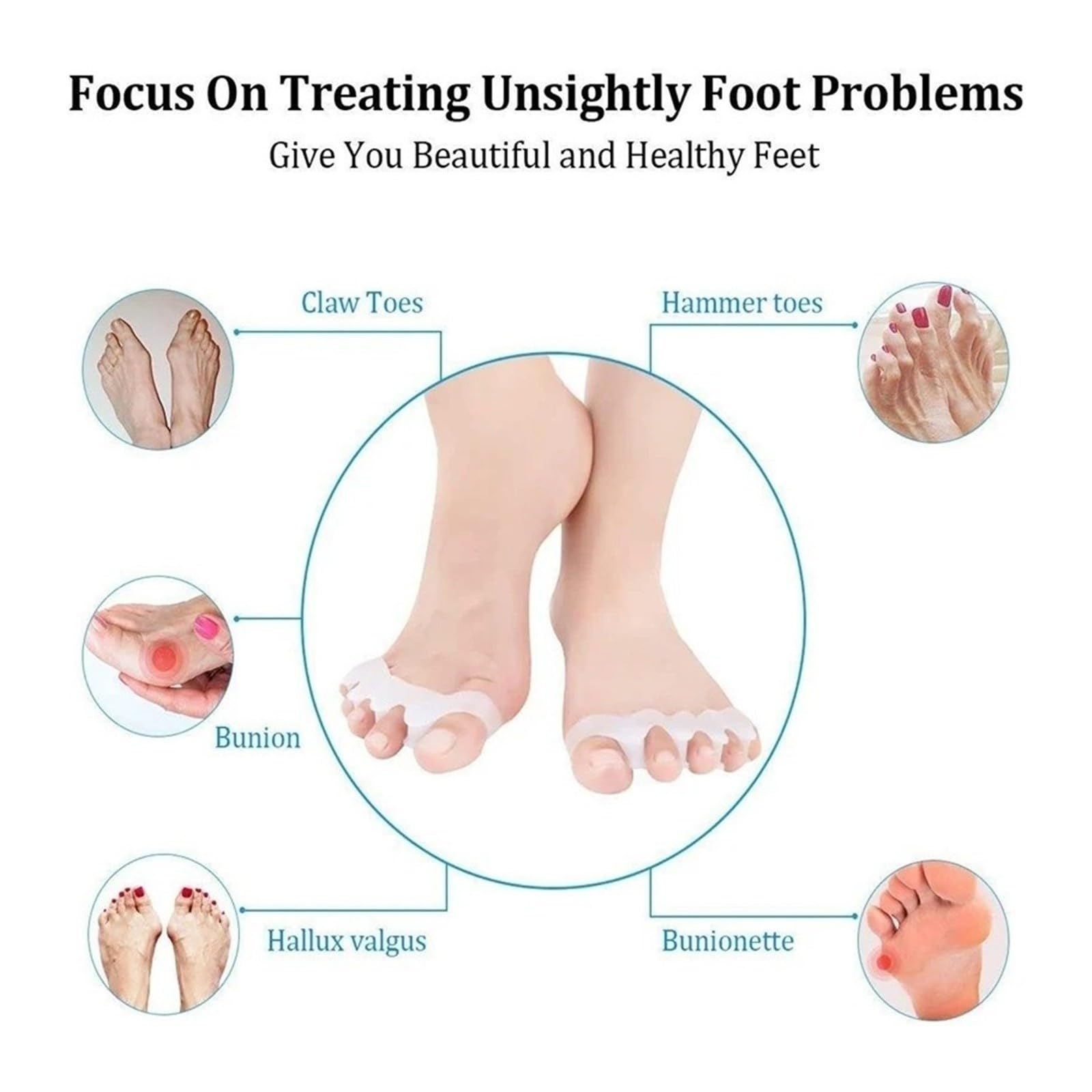 Silicone Toe Separator Hammer Bunion Gel Cushion 1 Pair Protective Pad Foot Care Tool(Skin)