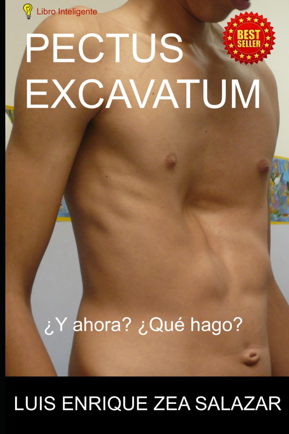 PECTUS EXCAVATUM: ¿Y ahora? ¿Que hago? (Spanish Edition)