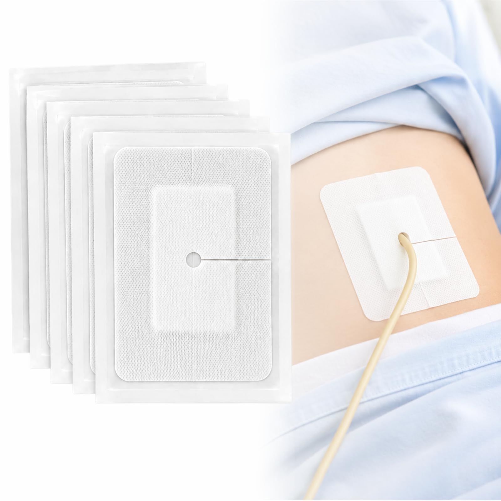 Dressing di sicurezza del catetere adesivo diviso per la cura(4 * 6",10pcs) | Materiale non tessuto, angoli arrotondati resistenti al curling, progettato per i siti del catetere PD