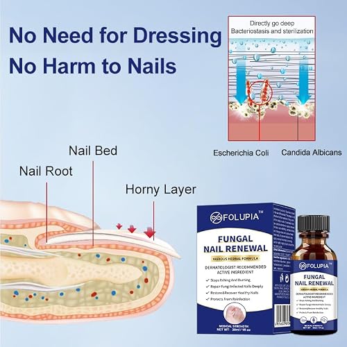 Treatment extra strength Toenail Fungus Treatment Extra Strength,Nail Fungus Treatment For Toenail,Athletes Foot Treatment,Ingrown Toenail Treatment,Toe Nail Fungus Treatments For Fungi Nail 2 Pack - Thumbnail 5