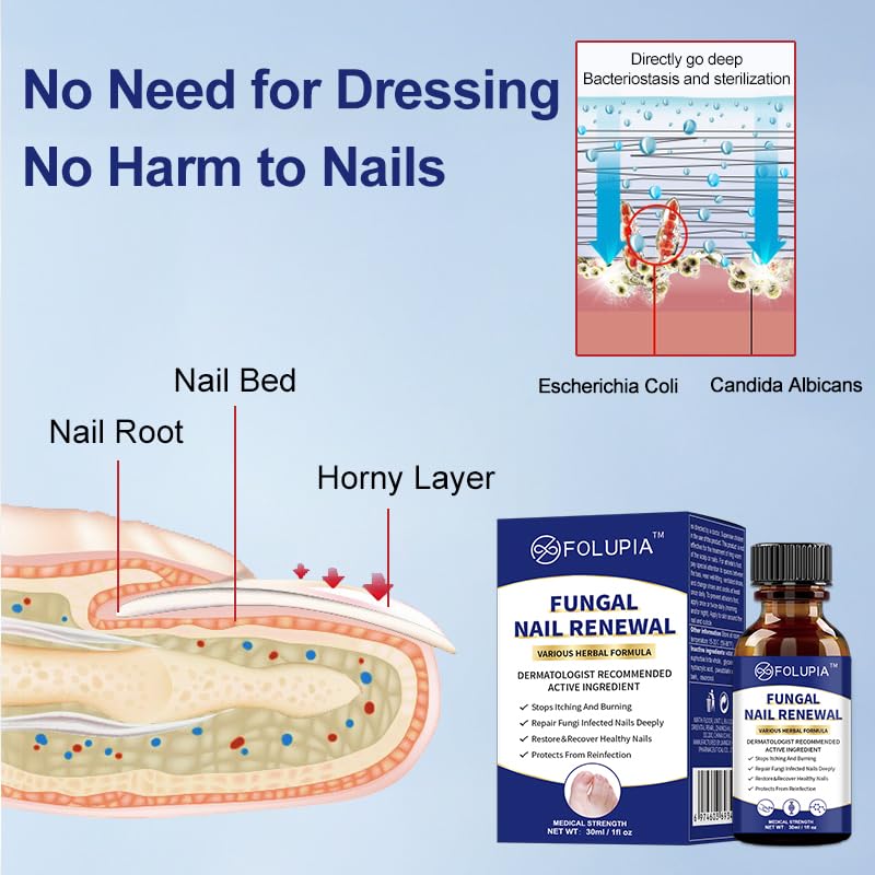 2 ANTI FUNGAL Support EXTRA STRENGTH TOENAIL FUNGUS ATHLETES FOOT FUNGI NAIL 2