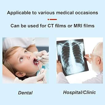 X-Ray Film Illuminator Light Box, 0.6in Thick X-ray Viewing Lamp, Dental Lab Equipment, with Hook, Easy to Install