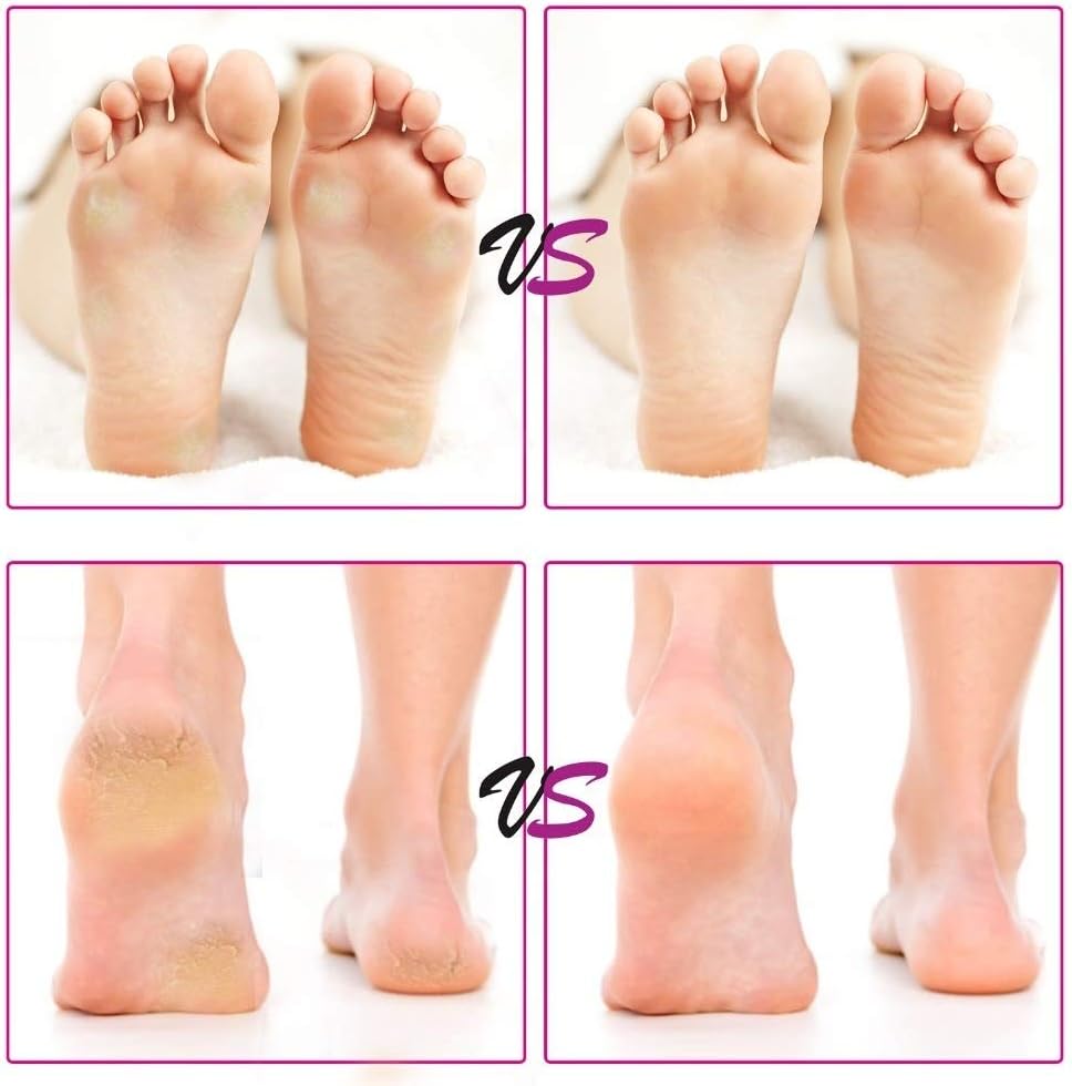 Electric Pedicure Tools Foot Care Tool Dry Dead Hard Skin Callus Remover Replacement Sandpaper Disk File