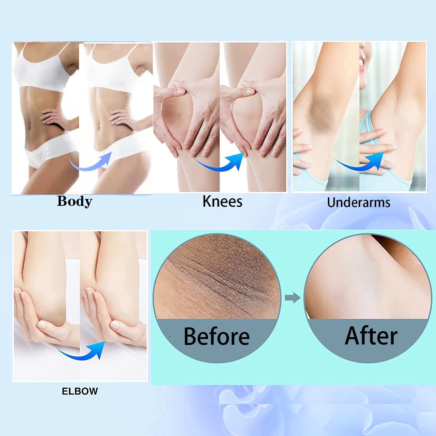 Intimate Area Dark Spot Remover Corrector For Body, Underarms, Armpit, Knees, Elbows, and inner Thigh All-Natural Designed by USA : Beauty & Personal Care