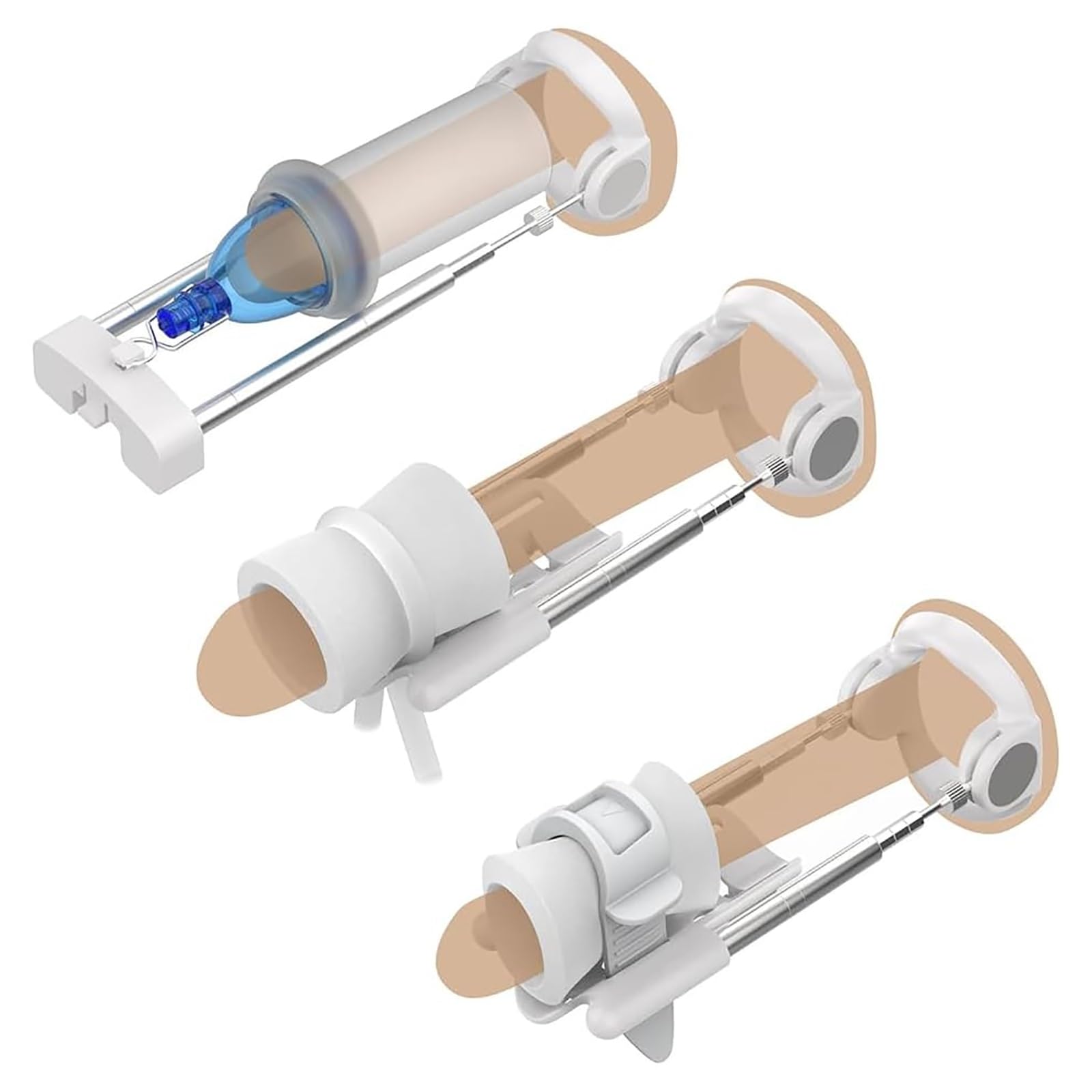 Enlargement Penis Extender Medical Free, Pompa for pene/Allargatore Allungamento della tensione maschile
