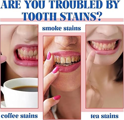 Miniatura 2 de 2PCS-SP-6 Pasta de dientes blanqueadora, blanqueamiento dental, sin esmalte, sin flúor, menta fresca, aliento fresco