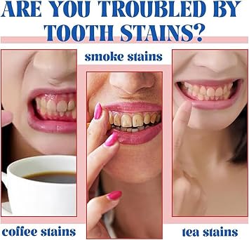 2PCS-SP-6 Whitening Toothpaste, Teeth Whitening, Enamel-Safe, Fluoride-Free, Fresh Mint, Fresh Breath