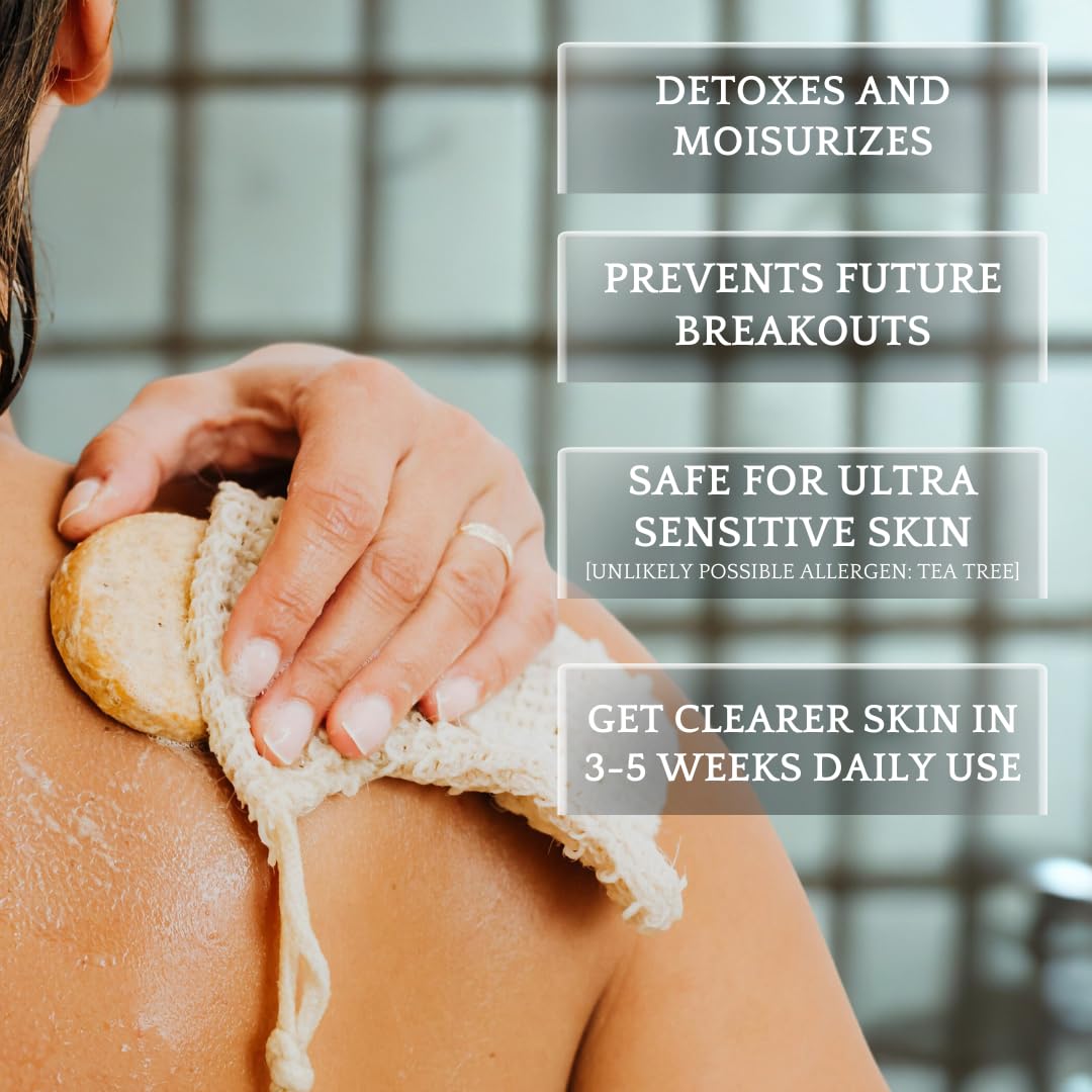 Bacne Wash: All Natural Back Acne Cleanser with Charcoal, Jojoba Oil, Tea Tree Oil, Neem Oil, Aloe Vera, Colloidal Oatmeal, and Vitamin E - Body Acne Wash for All Skin Types