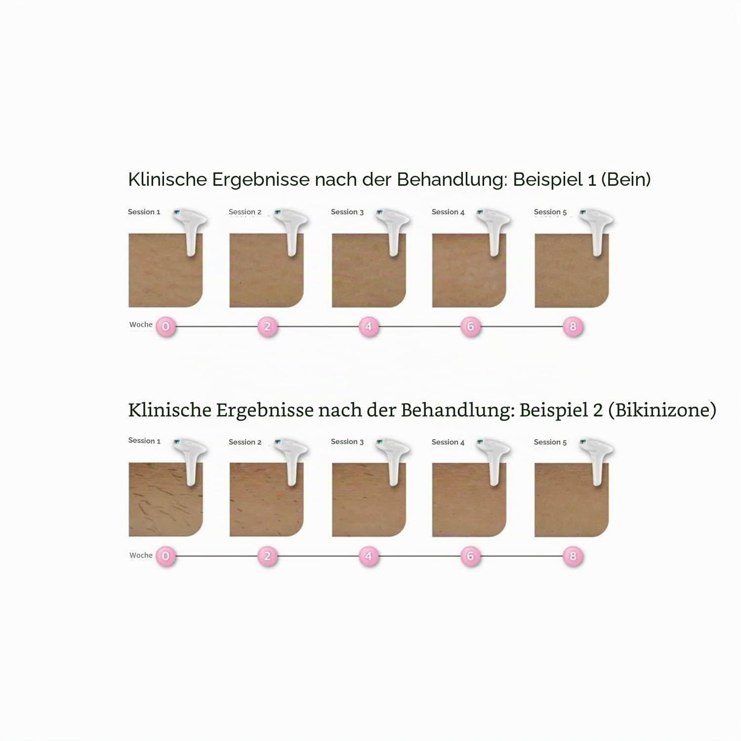 Philips Lumea Advanced IPL Haarentfernungsgerät SC1999/00