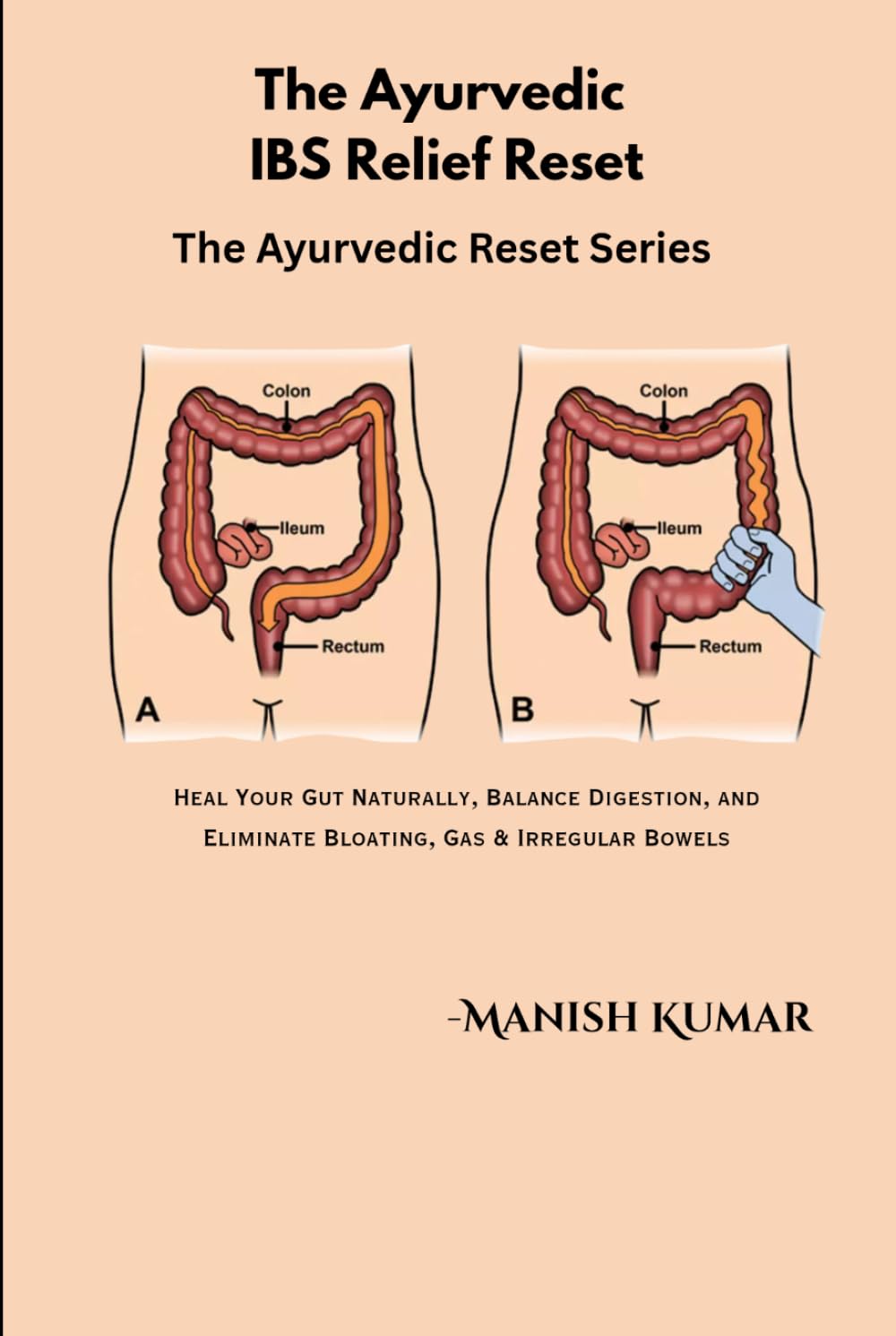 The Ayurvedic IBS Relief Reset: Heal Your Gut Naturally, Balance Digestion, and Eliminate Bloating, Gas & Irregular Bowels (The Ayurvedic Reset Series)
